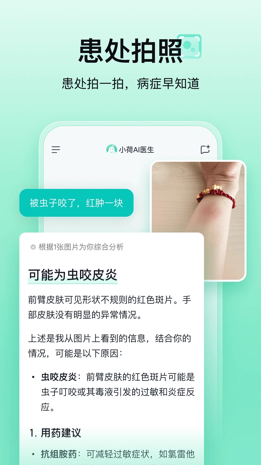小荷AI醫生